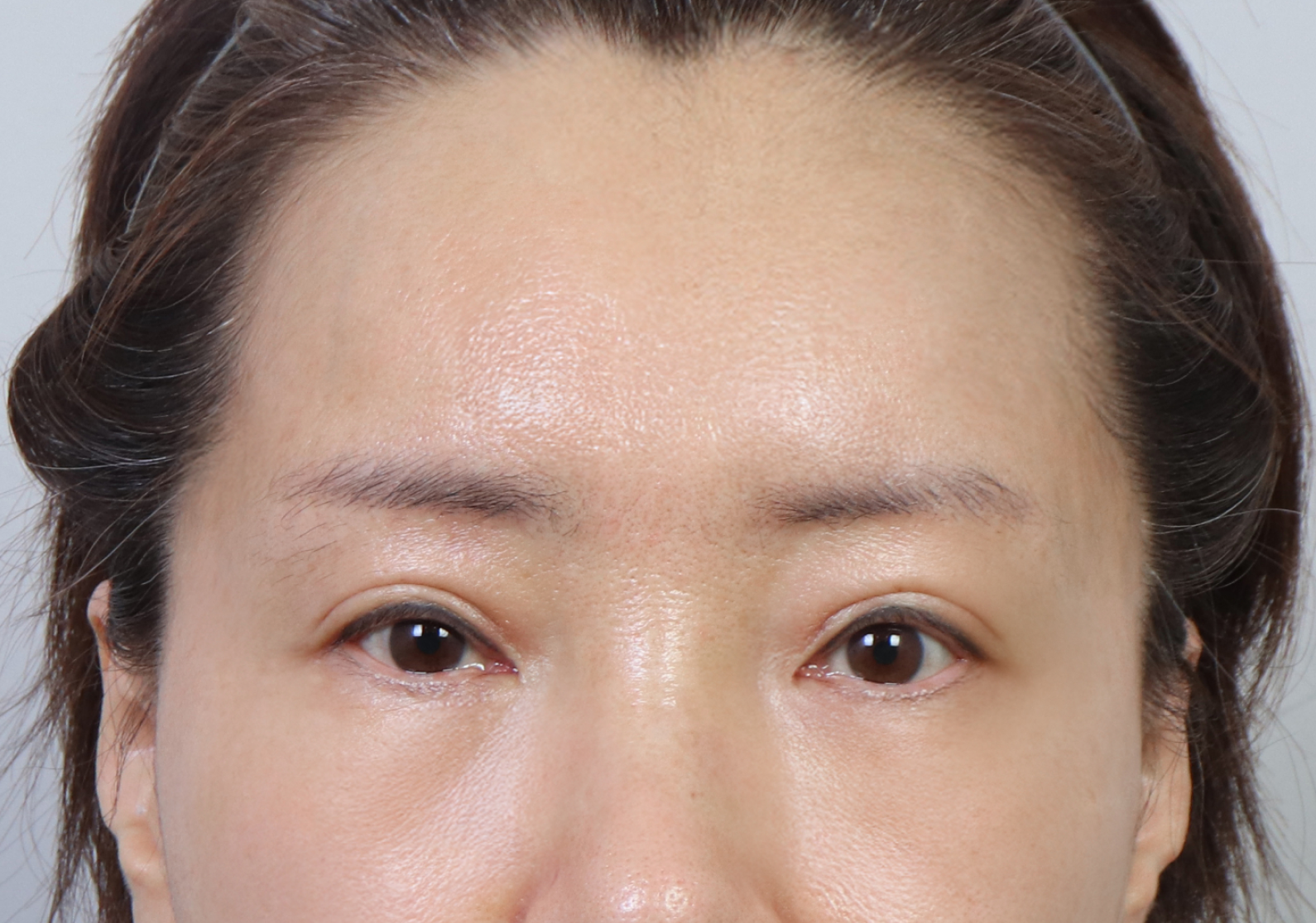 upper_02_after