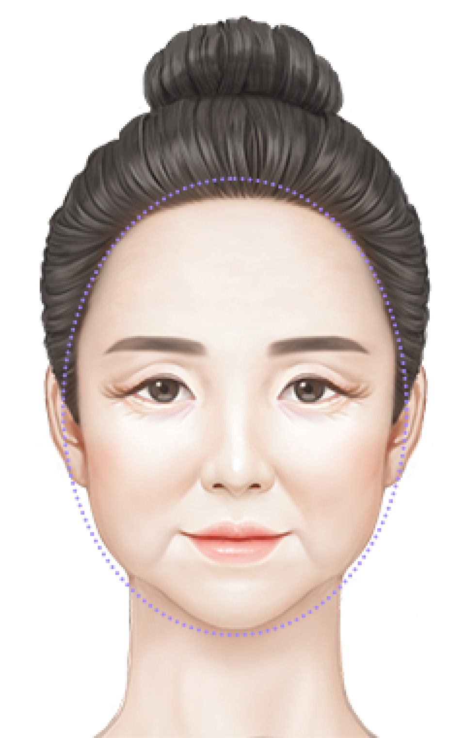 처짐 부위 3
