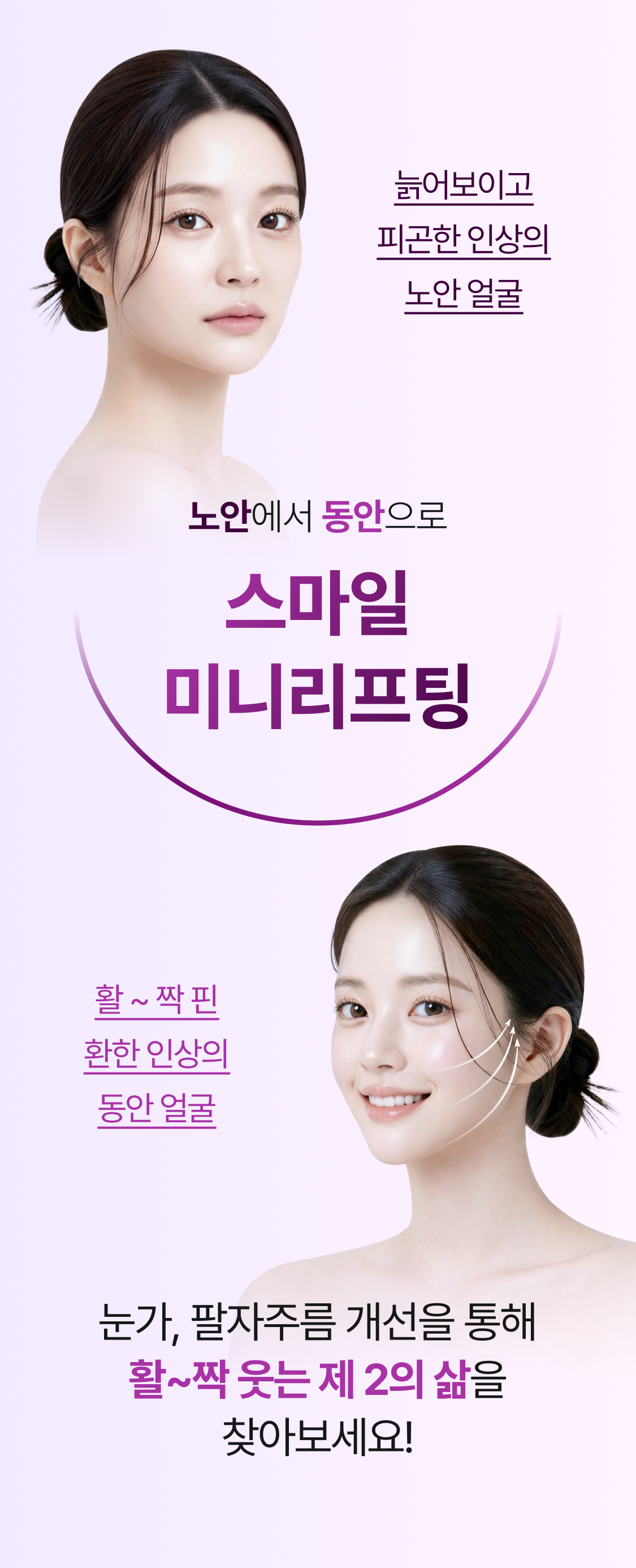 늙어보이고 피곤한 인상의 노안얼굴 vs. 활~짝 핀 환한 인상의 동안 얼굴