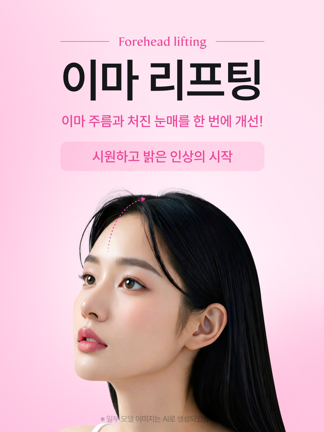 이마 리프팅