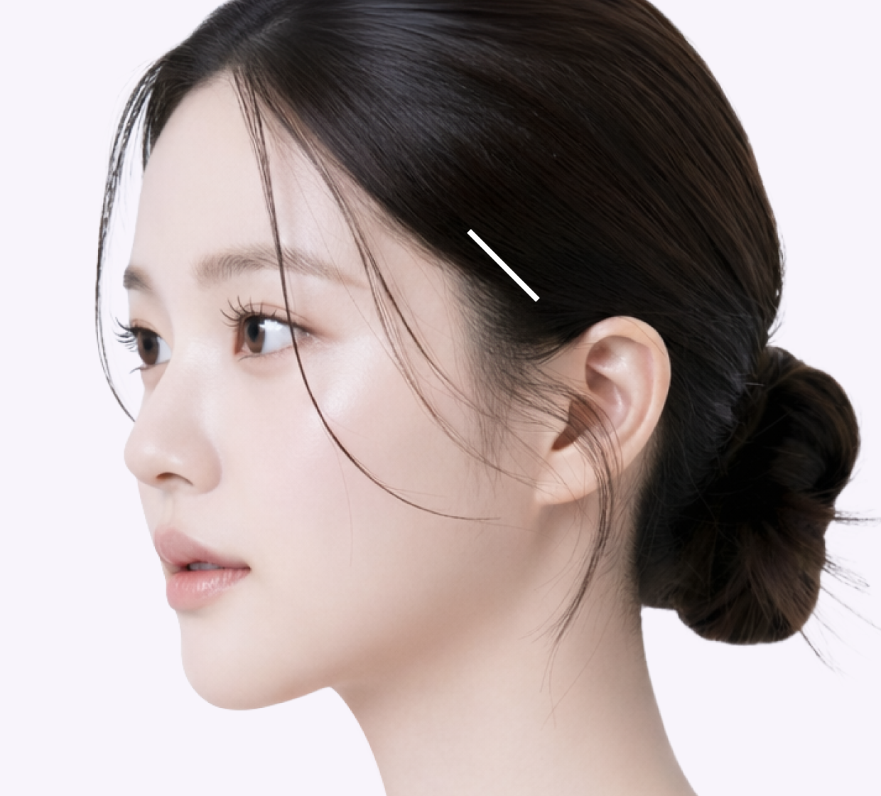 적은 절개