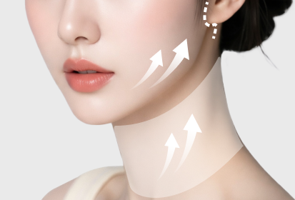 브이넥(VN)리프팅