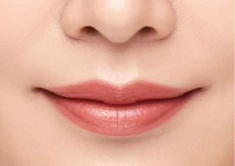 인중축소술 2단계 