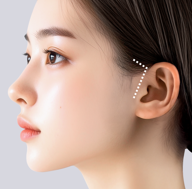 리팅 심플거상