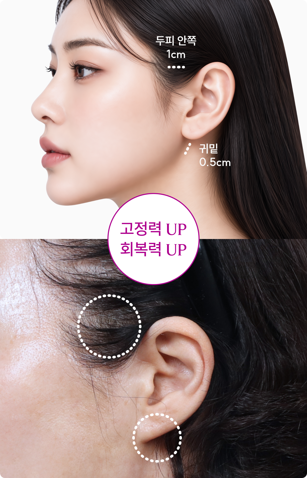 고정력 UP 회복력 UP