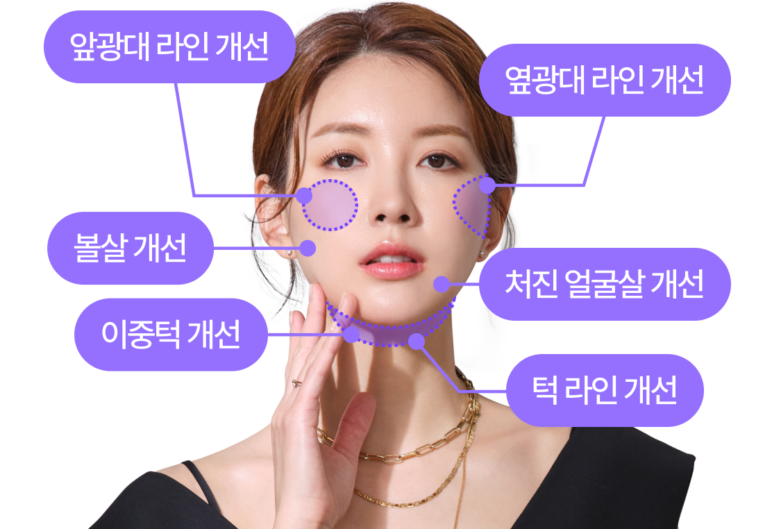 옆광대 라인 개선, 볼살 개선, 이중턱 개선, 옆광대 라인 개선, 처진 얼굴살 개선, 턱라인 개선