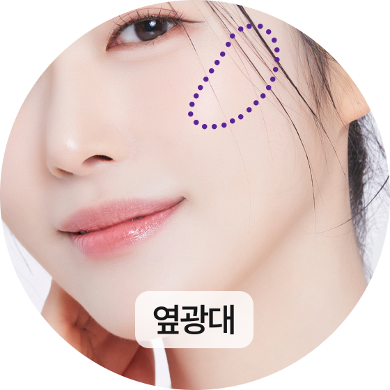 옆광대