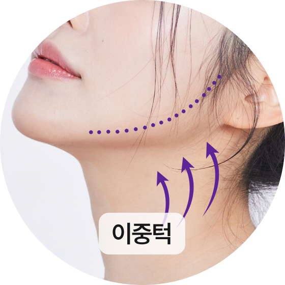 이중턱