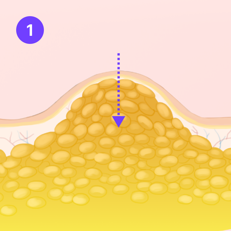 step 01