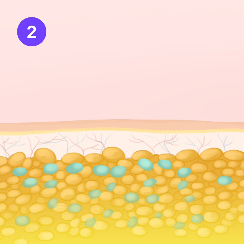 step 02