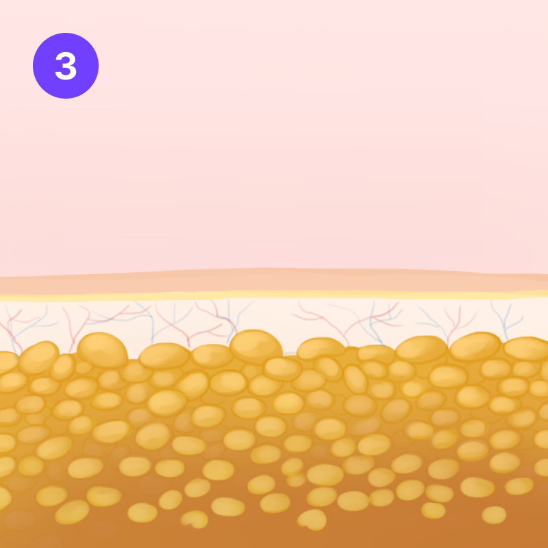 step 03