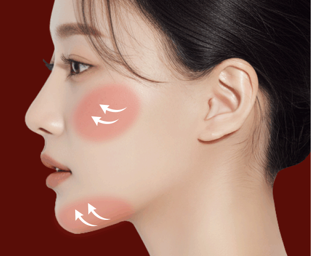 미니윤곽술 + 턱선 상부 보강(볼,턱 라인)