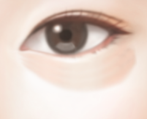 대상 2