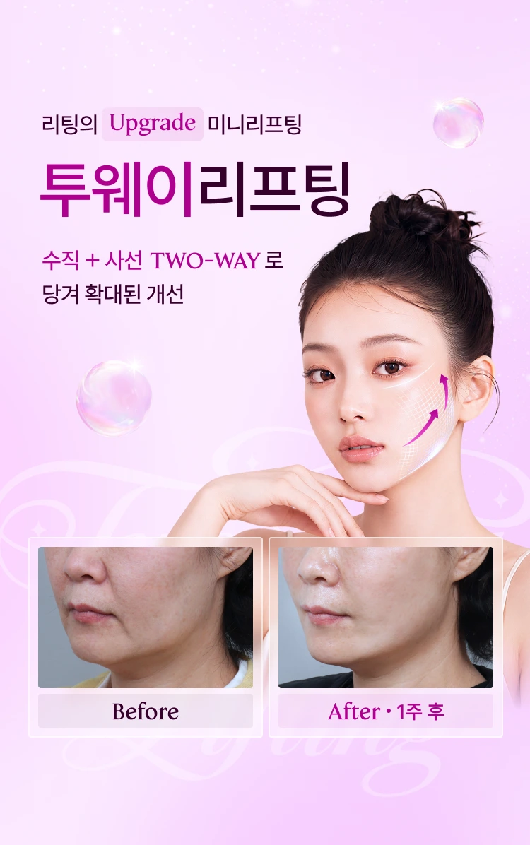 리팅의 Upgrade 미니리프팅 투웨이리프팅 수직+사선 TWO-WAY로 당겨 확대된 개선